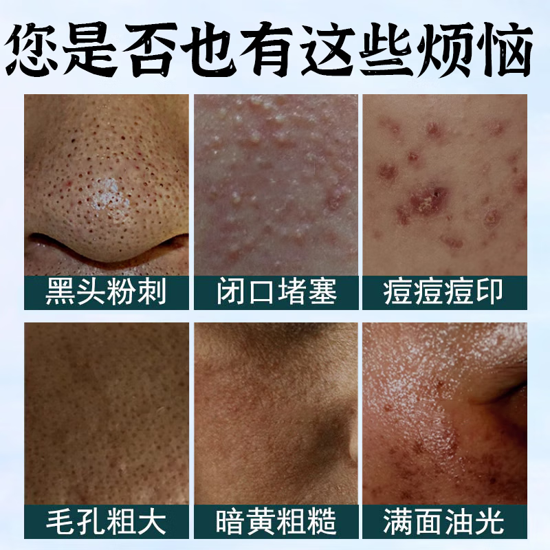 倾姿堂 美白保湿洗面奶男女（买1 送1）祛斑洁面乳去清洁黑头斑点亮肤 1支装（100g）缩略图 3