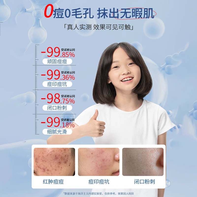 [胖东來&官方自营]15%壬二酸凝胶去黑头闭口淡化痘印坑舒缓保湿清爽学生护肤祛痘膏缩略图 5