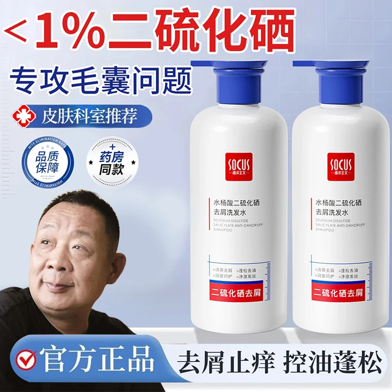 [许昌自营&胖东來严选]二硫化硒洗发水控油去屑止痒脂溢性女男士通用官方正品